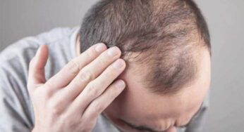 Hair Fall : వీటిని వ‌రుస‌గా 10 రోజుల పాటు తినండి.. జుట్టు రాల‌డం త‌గ్గిపోతుంది..!