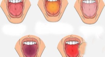 Tongue Color : మీ నాలుక ఉన్న రంగును బట్టి మీకున్న వ్యాధులు ఏమిటో ఇలా తెలుసుకోండి..!