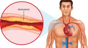 Cholesterol : ఈ మూడు ర‌కాల పండ్లను రోజూ తినండి చాలు.. కొలెస్ట్రాల్ మొత్తం క‌రిగిపోతుంది..!