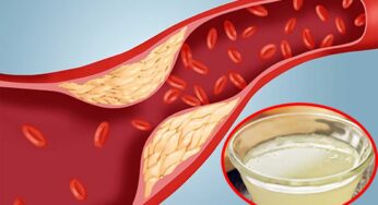 Cholesterol : దీన్ని తాగితే ర‌క్త‌నాళాలు మొత్తం క్లీన్‌.. కొలెస్ట్రాల్ పేరుకుపోదు..!