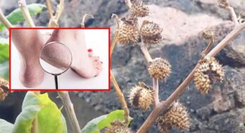 Ummetha Seeds : పాదాల ప‌గుళ్ల‌ను త‌గ్గించే సుల‌భ‌మైన చిట్కా.. పాదాలు అందంగా మారుతాయి..!