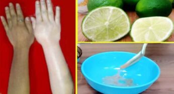 Lemon For Beauty : 7 రోజుల్లో మీ ముఖం అందంగా మారాలంటే.. నిమ్మకాయతో ఇలాచేయండి..