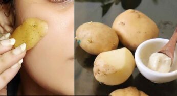 Potato Skin : ఆలుగ‌డ్డ తొక్కని ప‌డేయ‌కండి.. దాంతో ఈ విధంగా చేస్తే మీ చ‌ర్మం మిల‌మిలలాడుతుంది..