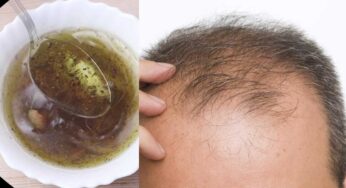 Hair Oil : జుట్టు ఊడిన చోట ఈ నూనెతో మ‌సాజ్ చేయండి.. జుట్టు మొలుస్తుంది..