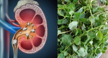 Kidney Stones : ఈ మొక్క ఆకుల‌ను రోజూ తింటే..ఎలాంటి కిడ్నీ స్టోన్స్ అయినా స‌రే క‌రిగిపోతాయి..