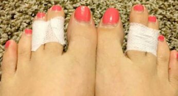 Taping Toes : కాలి చూపుడు వేలికి, మ‌ధ్య వేలికి రాత్రి పూట‌ టేప్ వేసి ప‌డుకుంటే ఏం జ‌రుగుతుందో తెలుసా..?