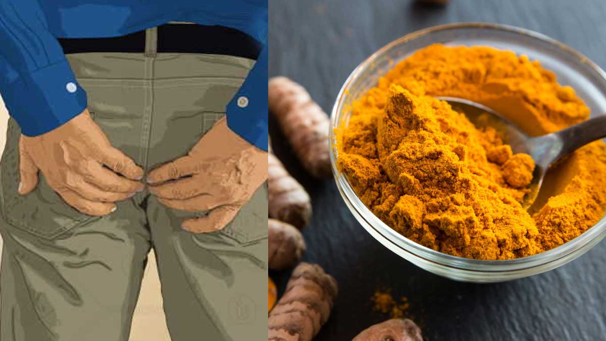 Turmeric For Piles ప‌సుపుతో పైల్స్‌ను ఇలా త‌గ్గించుకోండి.. ఎలా ఉప