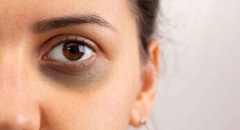 Dark Circles : మీ క‌ళ్ల కింద ఉండే న‌ల్ల‌ని వ‌ల‌యాలు, మ‌చ్చ‌లు, న‌లుపును త‌గ్గించే చిట్కాలు.. ఒక్క‌సారి వాడితే చాలు..