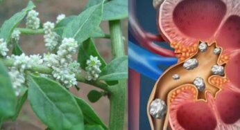 Kidney Stones : ఈ ఆకుల‌ను ఇలా వాడితే.. కిడ్నీల్లో ఉండే ఎంత‌టి స్టోన్స్ అయినా స‌రే బ‌య‌ట‌కు వ‌చ్చేస్తాయి..