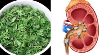 Kidneys Health : కిడ్నీలో రాళ్ల‌ను వేగంగా క‌రిగించే ఆకు ఇది.. ఎలా వాడాలంటే..?