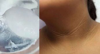 Neck Darkness Remedy : మెడ‌పై ఉండే న‌లుపుద‌నాన్ని పోగొట్టే అద్భుత‌మైన చిట్కా.. వాడితే చాలు.. రిజ‌ల్ట్ తెలిసిపోతుంది..