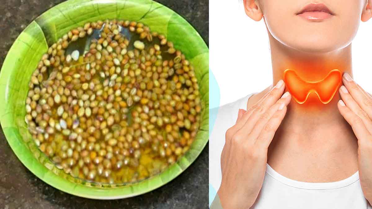 Coriander Seeds For Thyroid ఈ గింజ‌ల‌ను ఇలా తీసుకుంటే.. థైరాయిడ్ స‌మ