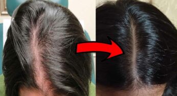 Amla For Black Hair : రాత్రి దీన్ని త‌ల‌కు రాసి ఉద‌యం స్నానం చేయండి.. తెల్ల జుట్టు న‌ల్ల‌గా మారుతుంది..