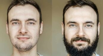 Beard Growth Tips : గ‌డ్డం పెర‌గ‌డం లేద‌ని బాధ‌ప‌డుతున్నారా.. అయితే ఇలా చేయండి..