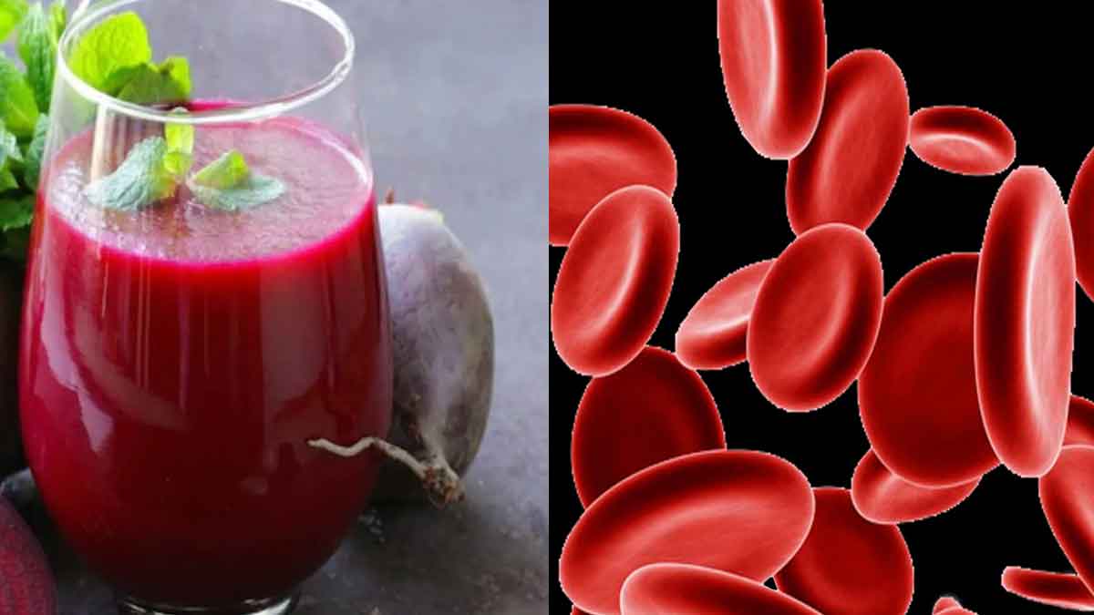 Beetroot For Anemia ర‌క్తం త‌క్కువ‌గా ఉందా.. దీన్ని తీసుకుంటే చాలు