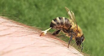 Honey Bees Sting : తేనెటీగ‌లు కుట్టిన‌ప్పుడు ఇలా చేయాలి.. నొప్పి, మంట నుంచి బ‌య‌ట ప‌డ‌తారు..