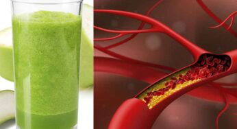 Bottle Gourd Juice For Cholesterol : దీన్ని తాగితే కొలెస్ట్రాల్ మొత్తం క‌రిగిపోతుంది.. గుండె ఆరోగ్యంగా ఉంటుంది..