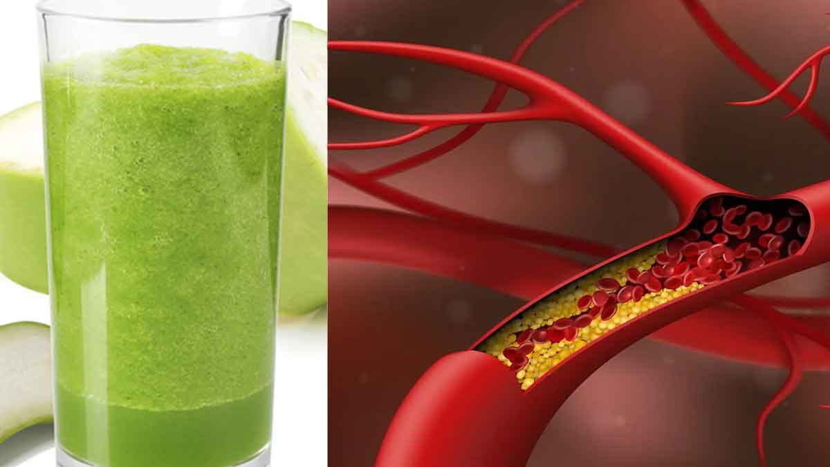 Bottle Gourd Juice For Cholesterol దీన్ని తాగితే కొలెస్ట్రాల్ మొత్తం