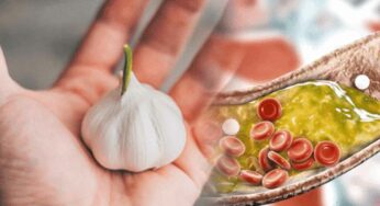 Garlic For Cholesterol : వెల్లుల్లిని రోజూ ఇలా తీసుకోండి.. కొలెస్ట్రాల్ మొత్తం క‌రిగిపోతుంది..