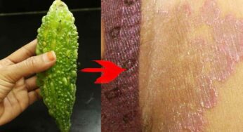 Bitter Gourd For Skin : కాక‌ర‌కాయ‌ల‌తో ఇలా చేస్తే చాలు.. చ‌ర్మంపై ఎలాంటి ఇన్‌ఫెక్ష‌న్లు, దుర‌ద‌లు ఉన్నా త‌గ్గుతాయి..!