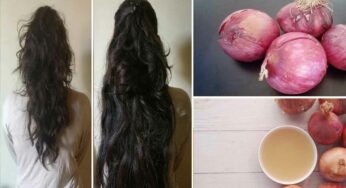 Onions For Hair : వారానికి రెండు సార్లు ఇలా చేస్తే చాలు.. జుట్టు ఎంత‌లా పెరుగుతుందంటే.. నమ్మ‌లేరు..!