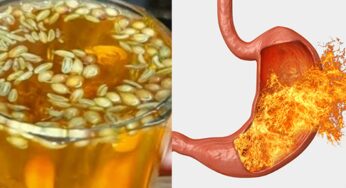 Acidity Remedy : ఎంత‌టి క‌డుపులో మంట అయినా స‌రే.. ఇలా నిమిషాల్లో త‌గ్గించుకోవ‌చ్చు..!