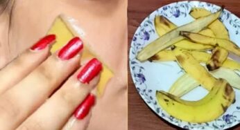 Banana Peel : రాత్రిపూట అర‌టి పండు తొక్క‌ను ముఖానికి రుద్దండి.. ఏం జ‌రుగుతుందో తెలుసా..?