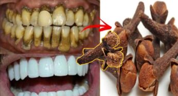 Cloves For Teeth : ల‌వంగాల‌తో ఇలా చేస్తే చాలు.. ఎంత‌టి ప‌సుపు దంతాలు అయినా స‌రే తెల్ల‌గా మారుతాయి..!