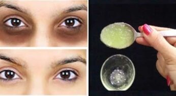 Dark Circles : రోజూ రాత్రి ఇలా చేస్తే చాలు.. క‌ళ్ల కింద న‌లుపు అస‌లు ఉండ‌దు..!