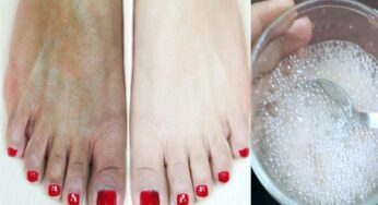 Feet Beauty : మీ పాదాల‌ను తెల్ల‌గా మార్చే చిట్కా.. ఇలా చేస్తే చాలు..!