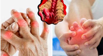 Uric Acid And Gout : యూరిక్ యాసిడ్‌, గౌట్ స‌మ‌స్య‌ల‌ను త‌గ్గించే అద్భుత‌మైన చిట్కాలు..!