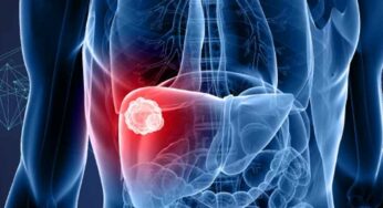 Liver Cancer Symptoms : ఈ ల‌క్ష‌ణాలు క‌నిపిస్తున్నాయా.. అయితే అది లివ‌ర్ క్యాన్స‌ర్ కావ‌చ్చు..!