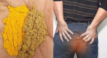 Remedies For Piles : మొల‌లు త‌గ్గాలంటే ఏం చేయాలి.. అద్భుత‌మైన చిట్కా..!