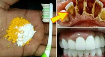 Yellow To White Teeth : 2 నిమిషాల్లో ఎంతటి గార పట్టిన పసుపు పళ్ళు అయినా ముత్యాల్లా మెరిసిపోతాయి..!