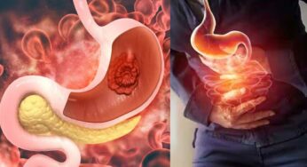 Gastric Problem : గ్యాస్ట్రిక్ స‌మ‌స్య రావ‌డానికి కార‌ణాలు ఇవే.. ల‌క్ష‌ణాలు.. చికిత్స విధానం.. ఆహారాలు..!