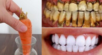 White Teeth With Carrot : ఒకే ఒక క్యారెట్‌తో 2 నిమిషాల్లోనే మీ దంతాలు తెల్ల‌గా మార‌డం ఖాయం..!