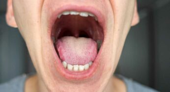 Diabetes And Mouth : మీ నోట్లో ఈ ల‌క్ష‌ణాలు క‌నిపిస్తున్నాయా.. అయితే మీకు డ‌యాబెటిస్ ఉన్న‌ట్లే..!