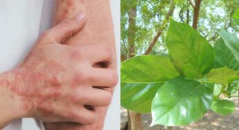 Kanuga For Skin Problems : దీన్ని ఇలా వాడితే చాలు.. మీకున్న చ‌ర్మ స‌మ‌స్య‌లు అన్నీ పోతాయి..!