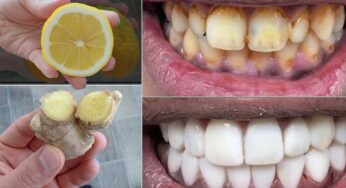 Lemon And Ginger For Teeth : అల్లం, నిమ్మ‌కాయ‌తో ఇలా చేస్తే.. ఎలాంటి దంతాలు అయినా స‌రే తెల్ల‌గా మారుతాయి..!