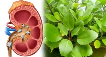 Ranapala For Kidney Stones : ఈ ఒక్క ఆకు తింటే చాలు.. ఎంత‌టి కిడ్నీ స్టోన్ అయినా స‌రే క‌రిగిపోవాల్సిందే..!