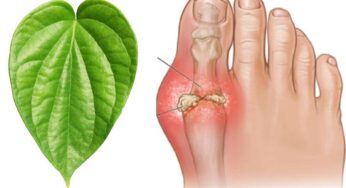 Betel Leaves For Uric Acid : మీకు యూరిక్ యాసిడ్ ఎక్కువ‌గా ఉందా.. అయితే త‌మ‌ల‌పాకుల‌ను ట్రై చేయండి..!