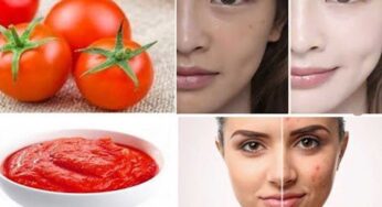 Tomato For Face : ట‌మాటాల‌తో ఇలా చేస్తే చాలు.. ఎండ వ‌ల్ల న‌ల్ల‌గా మారిన చ‌ర్మం.. తెల్ల‌గా అవుతుంది..!