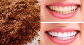 Cloves Powder For Teeth : మీ దంతాలు తెల్ల‌గా మారి మెరిసిపోవాలంటే.. ఈ చిట్కాను పాటించండి..!