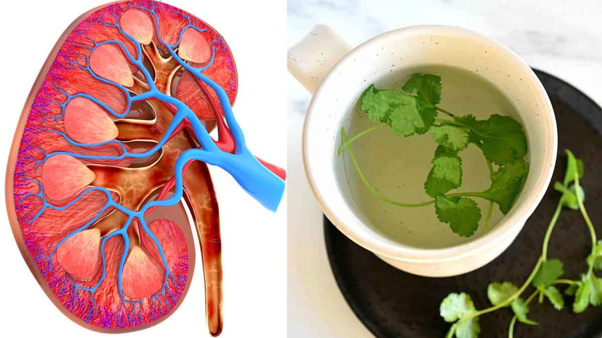 Coriander Leaves Water For Kidneys ఈ పానీయాన్ని రోజూ తాగితే చాలు.. మీ
