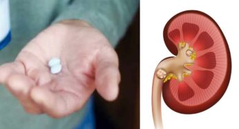 Calcium Tablets : కాల్షియం ట్యాబ్లెట్లను వేసుకుంటే కిడ్నీ స్టోన్లు ఏర్ప‌డుతాయా..?