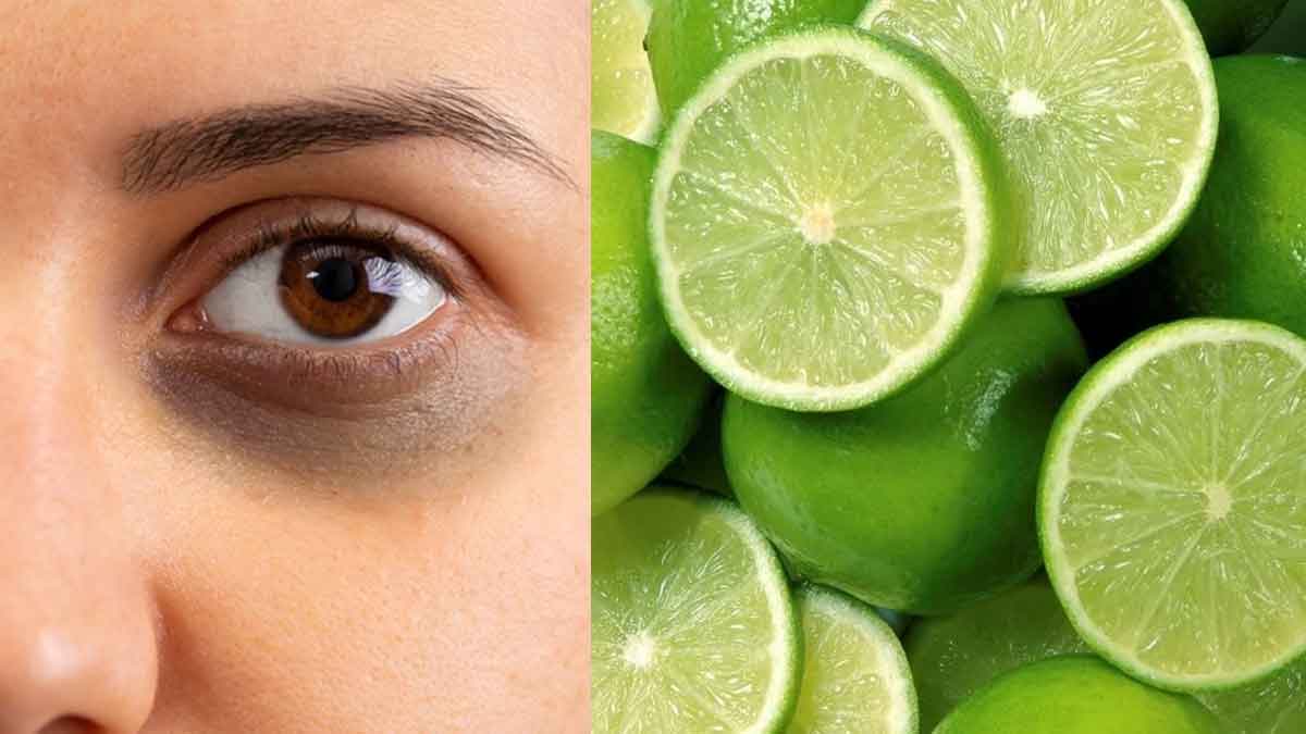 Dark Circles Home Remedies క‌ళ్ల కింద న‌లుపు త‌గ్గించే టాప్ రెమెడీస్