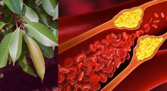 Leaves For Cholesterol : కొలెస్ట్రాల్ స్థాయిలు ఎక్కువ‌గా ఉన్నాయా.. అయితే ఈ 4 ర‌కాల ఆకుల‌ను రోజూ తీసుకోండి..!