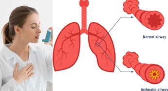 Asthma Health Tips : ఆస్త‌మా, పిల్లికూత‌ల స‌మ‌స్య‌కు ఇలా చేయండి.. దెబ్బ‌కు పోతుంది..!