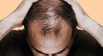 Hair Loss : రోజూ ఈ ఆహారాల‌ను తీసుకుంటే చాలు.. మీ జుట్టు వ‌ద్ద‌న్నా స‌రే పెరుగుతూనే ఉంటుంది..!