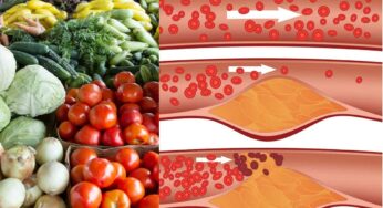 Vegetables For Cholesterol : చ‌లికాలంలో ఈ 9 ర‌కాల కూర‌గాయ‌ల‌ను తీసుకోండి.. కొలెస్ట్రాల్ అంతం అవుతుంది..!